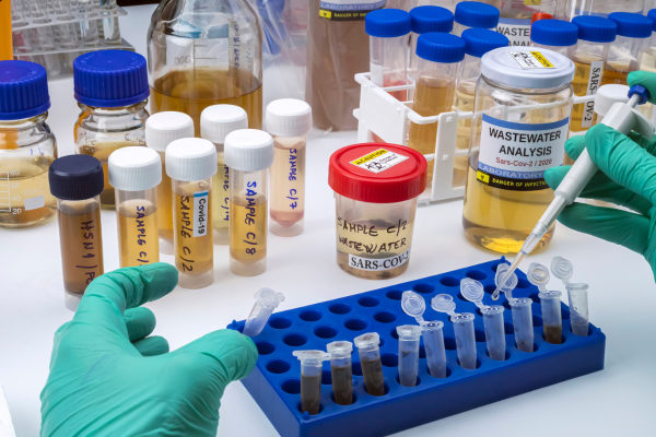 Por qué es importante hacerse exámenes de laboratorio anuales